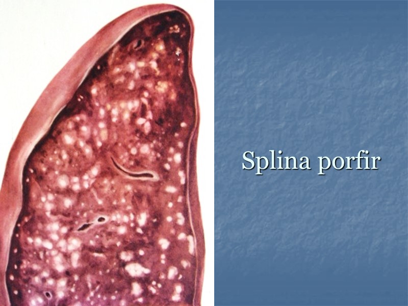 Splina porfir